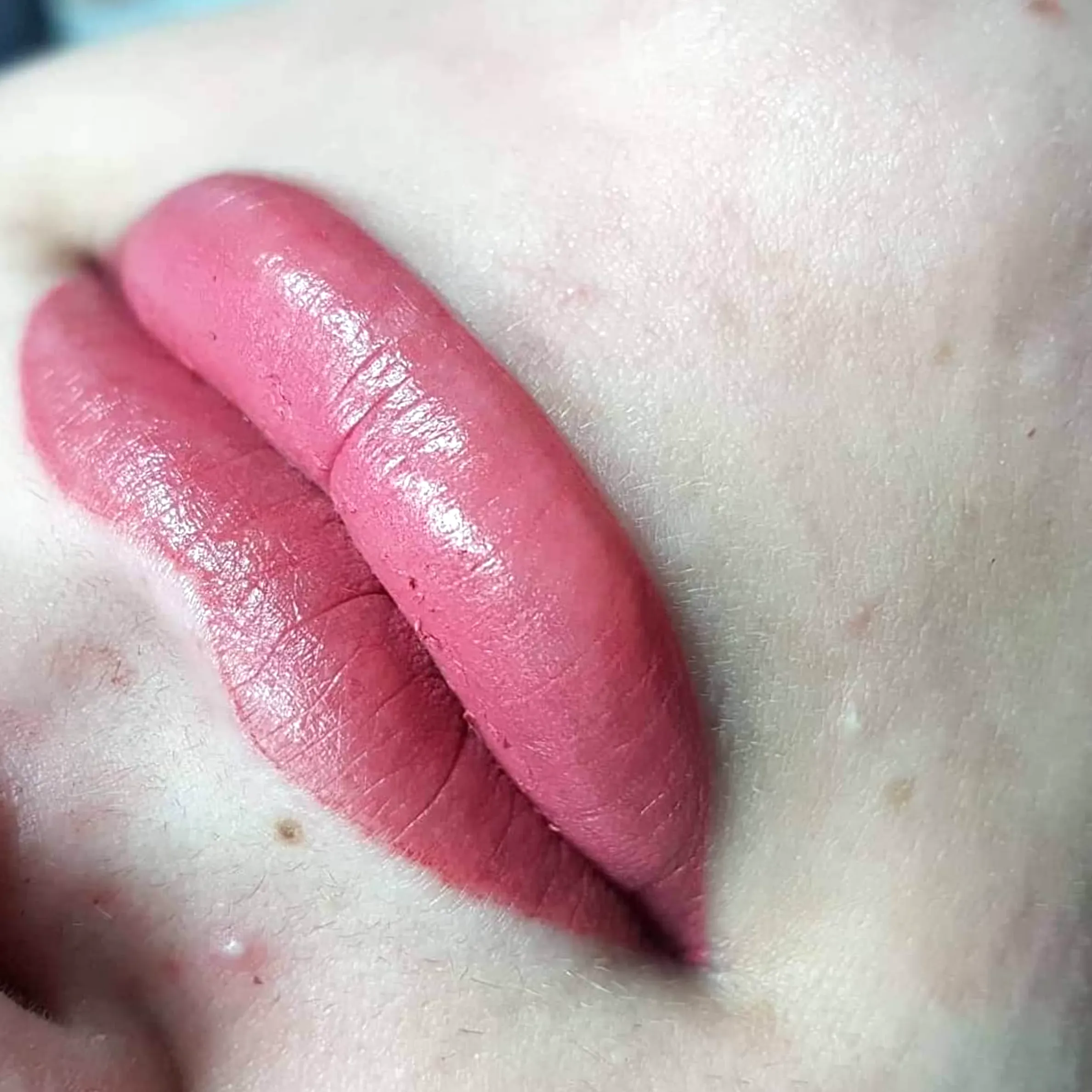 who is not a candidate for lip blush