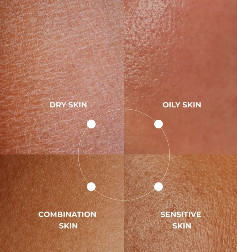 What Are The 4 Skin Types?