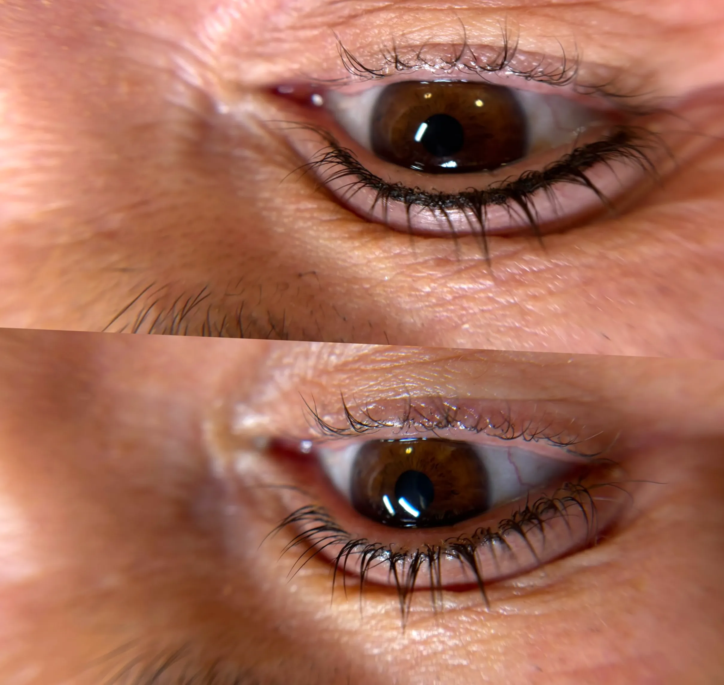 grey eyebrow tattoo removal