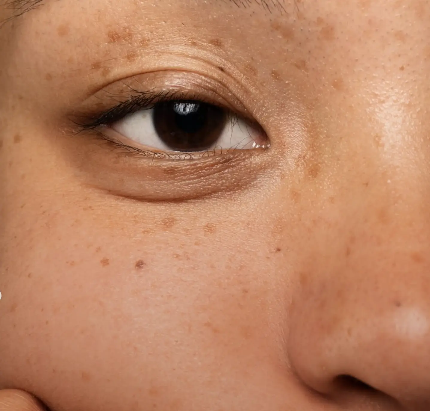 skincare for different skin types