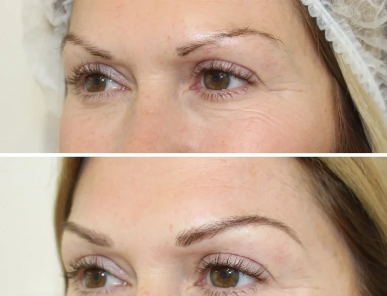 How Often Do I Need a Microblading Top-Up in Australia’s Climate?